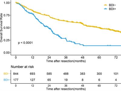 Redefining Hepatocellular Carcinoma Staging Systems Based on the Bile Duct Invasion Status: A Multicenter Study